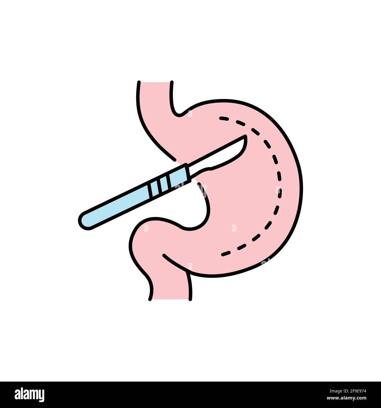 Stomach surgery olor line icon. Pictogram for web page, mobile app, promo. UI UX GUI design element. Editable stroke. Stock Vector