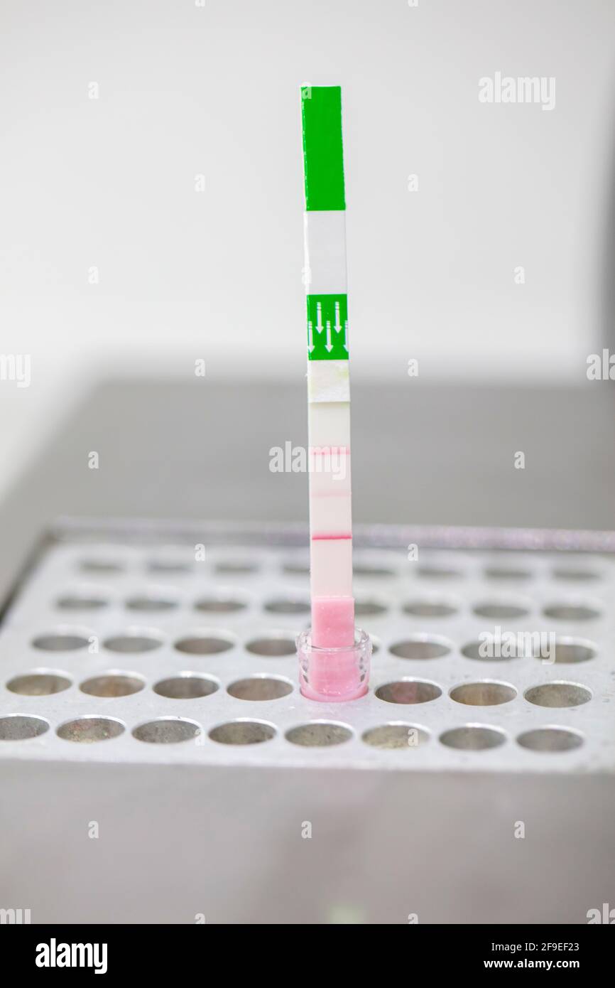 System for detection of inhibitors and antibiotics in animal milk. Milk