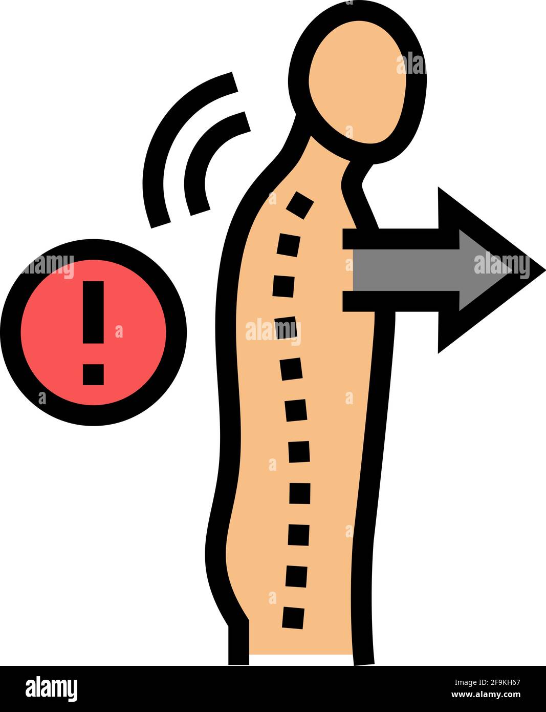 slouch scoliosis color icon vector illustration Stock Vector Image ...