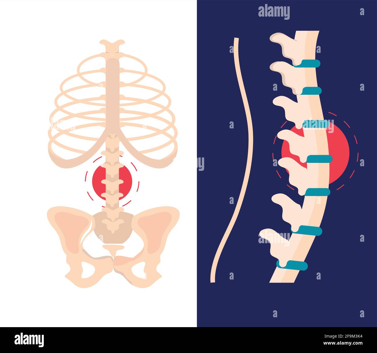 arthritis rheumatology spine anatomy science Stock Vector Image & Art