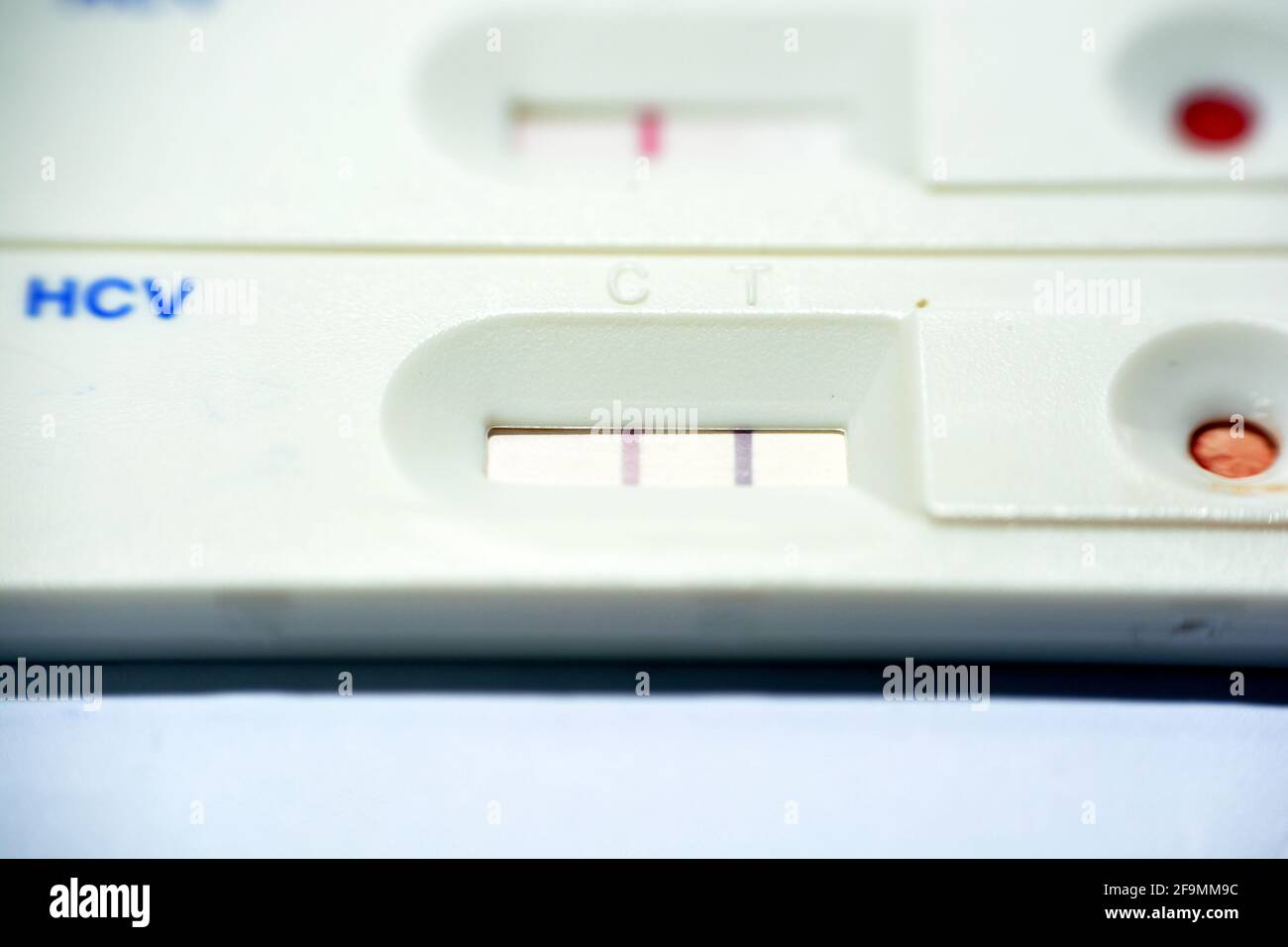 Hepatitis jaundice liver virus hires stock photography and images Alamy