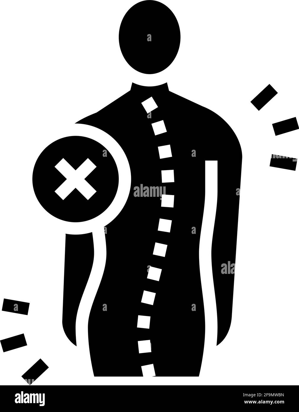 idiopathic scoliosis glyph icon vector illustration Stock Vector Image