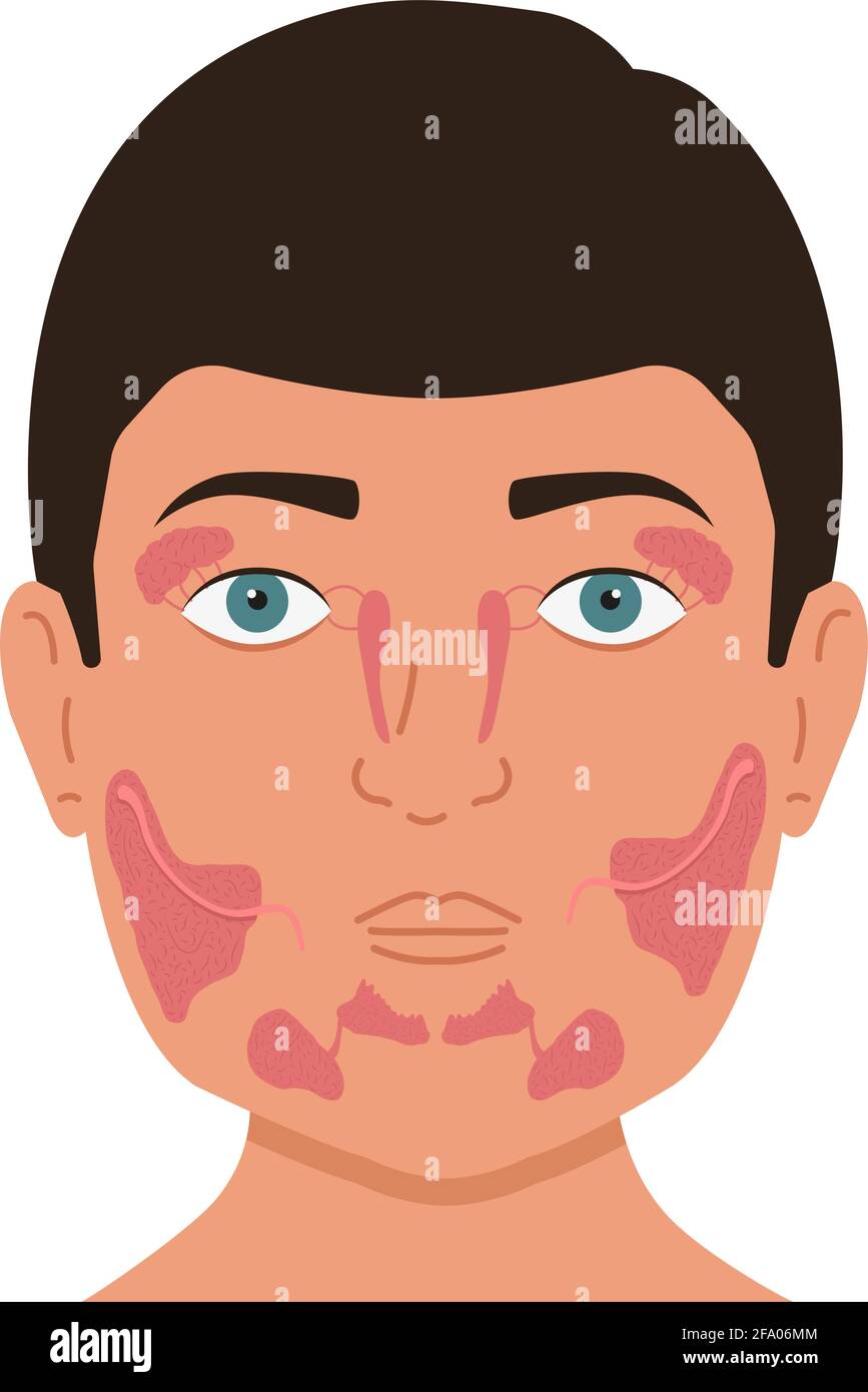 Person with lacrimal and salivary glands. Medical vector illustration. Stock Vector