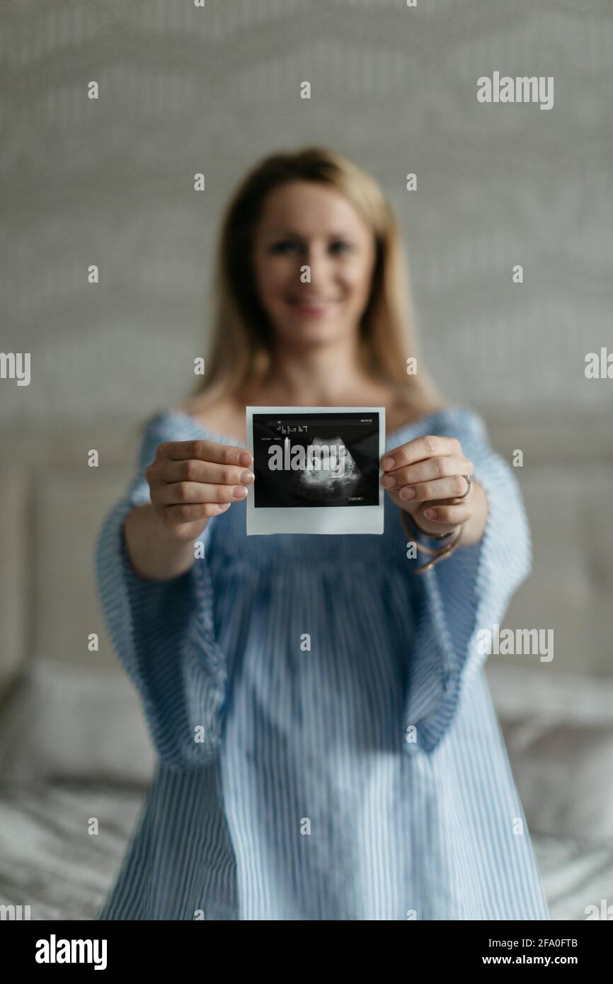 A portrait of a happy pregnant woman showing an ultrasound picture of her unborn baby into a camera. A cheerful expectant woman with a sonogram. Stock Photo