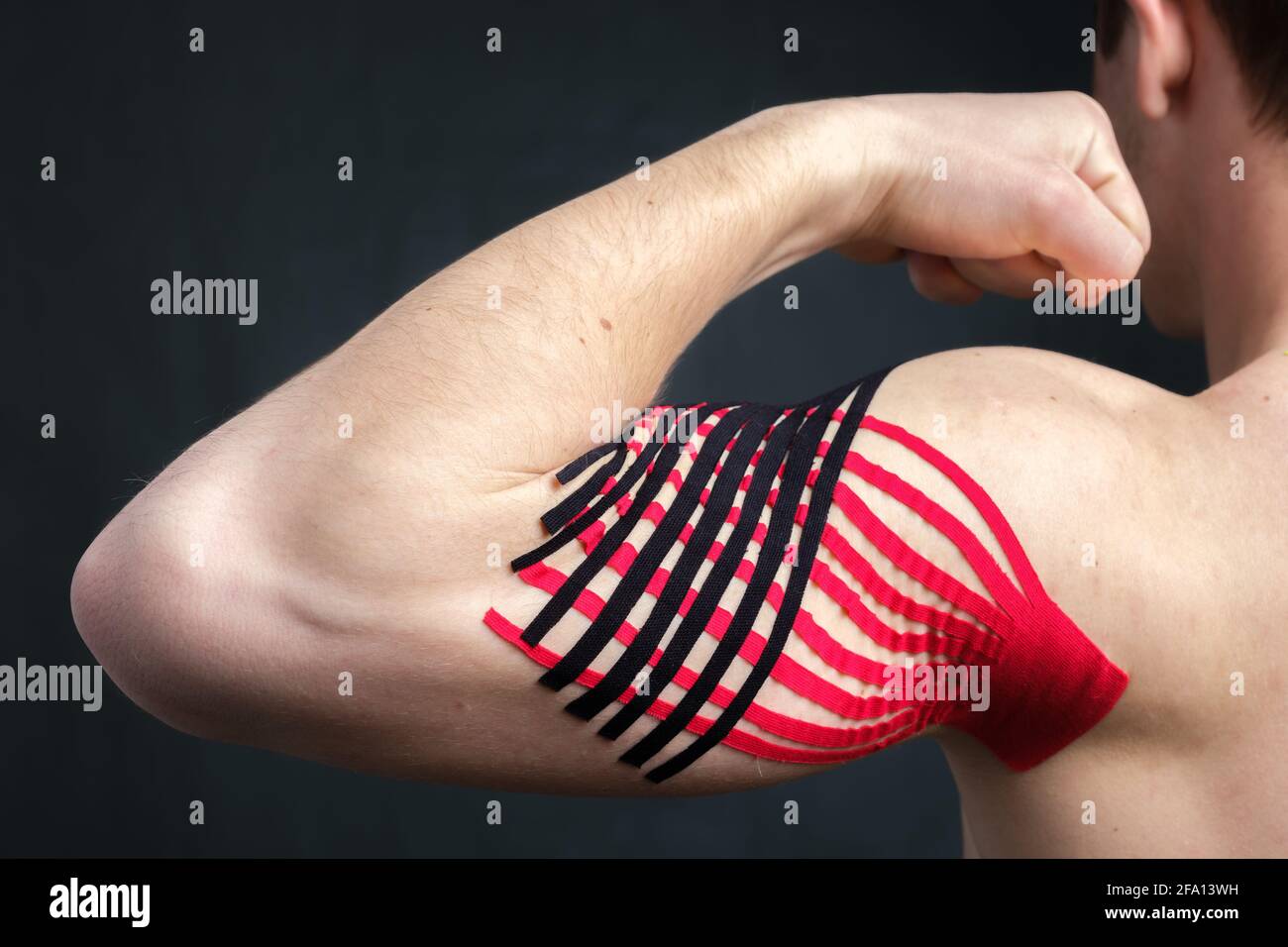 Man showing bicep with kinesiology medical tape applied to relieve pain
