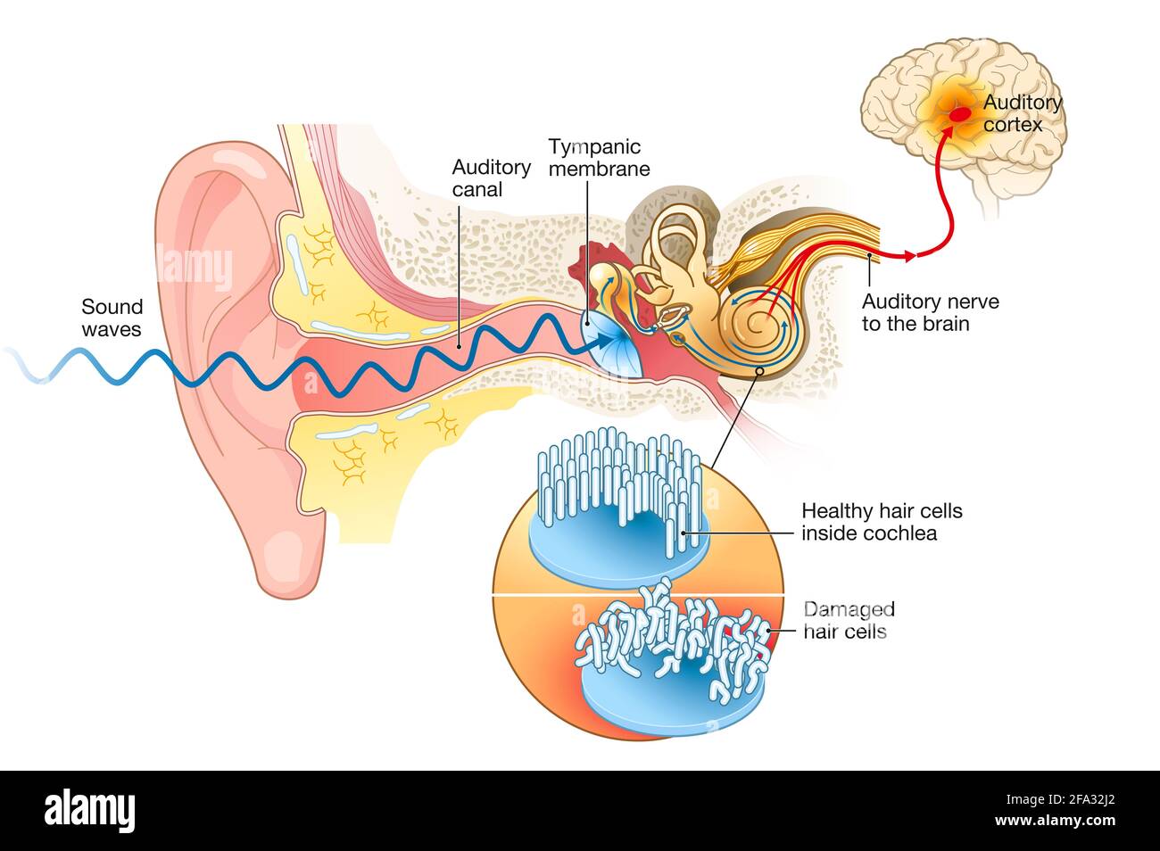 Dead Cells Ears Hair