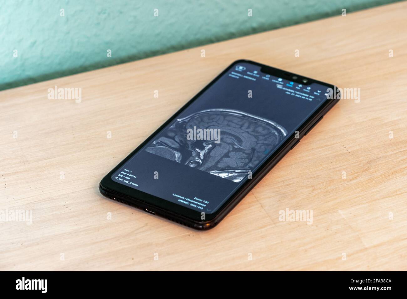 MRI Image of a Human Brain shown on a Smartphone Screen Stock Photo