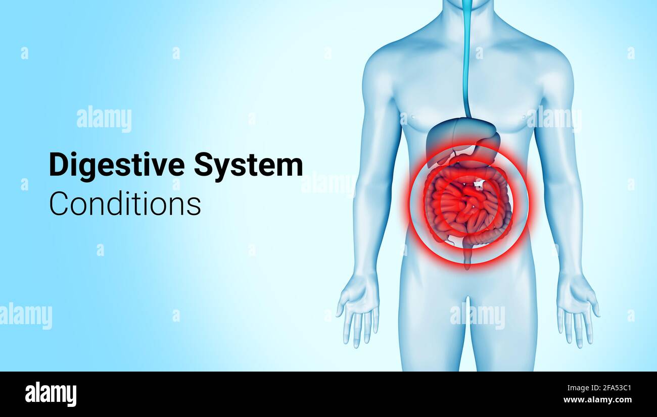 Digestive system pain on 3d illustration of male body. Intestines pain on anatomical digestive system infographic. Belly hurts illness. 3d rendering. Stock Photo