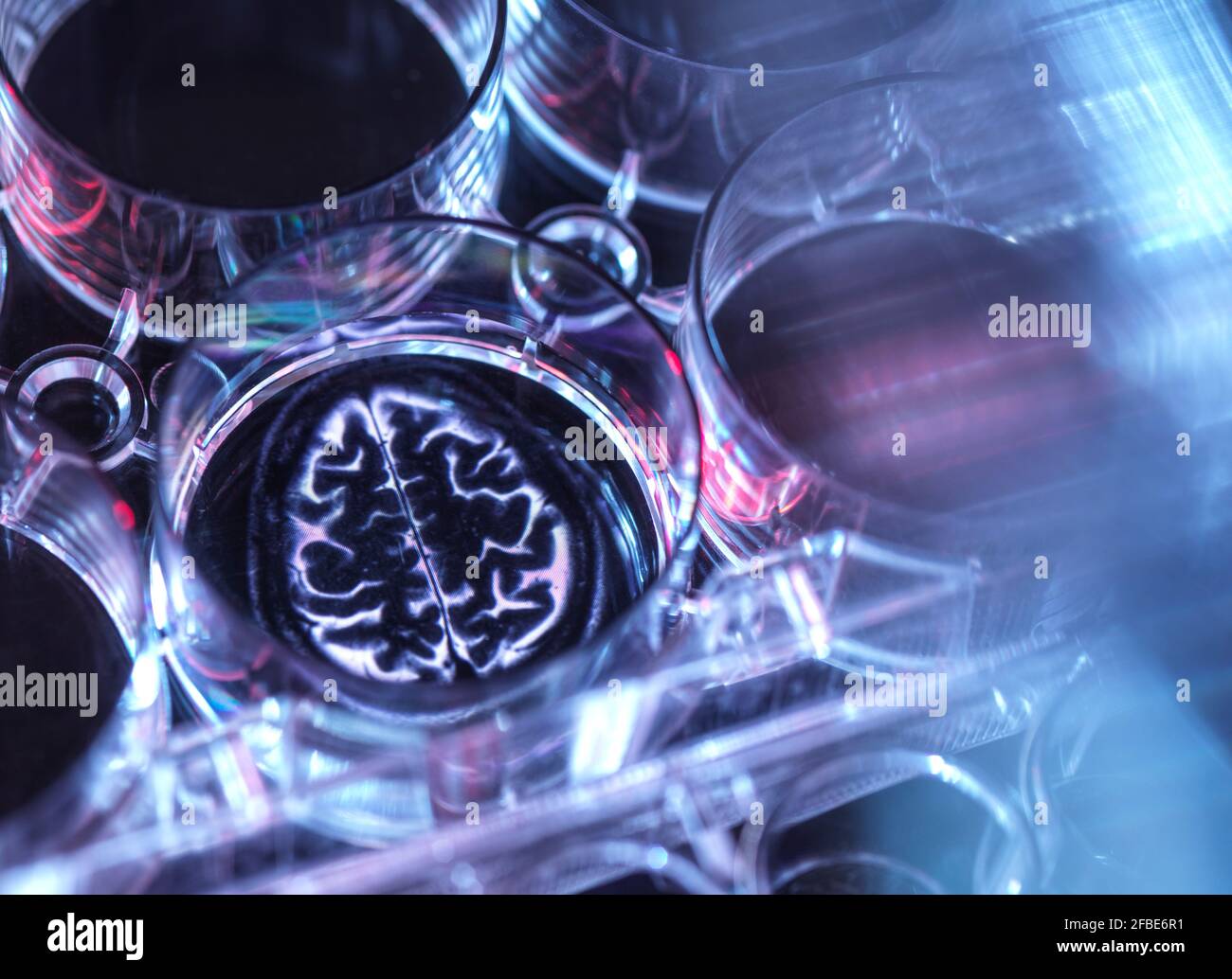 Medical sample inside microplate with image of human brain Stock Photo