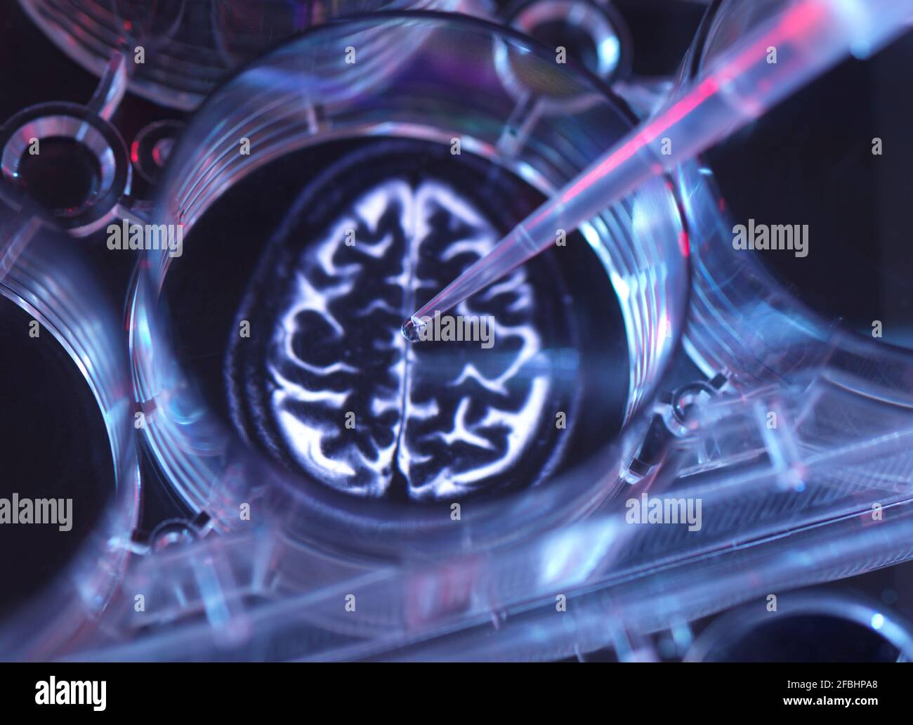 Medical sample inside microplate with image of human brain Stock Photo