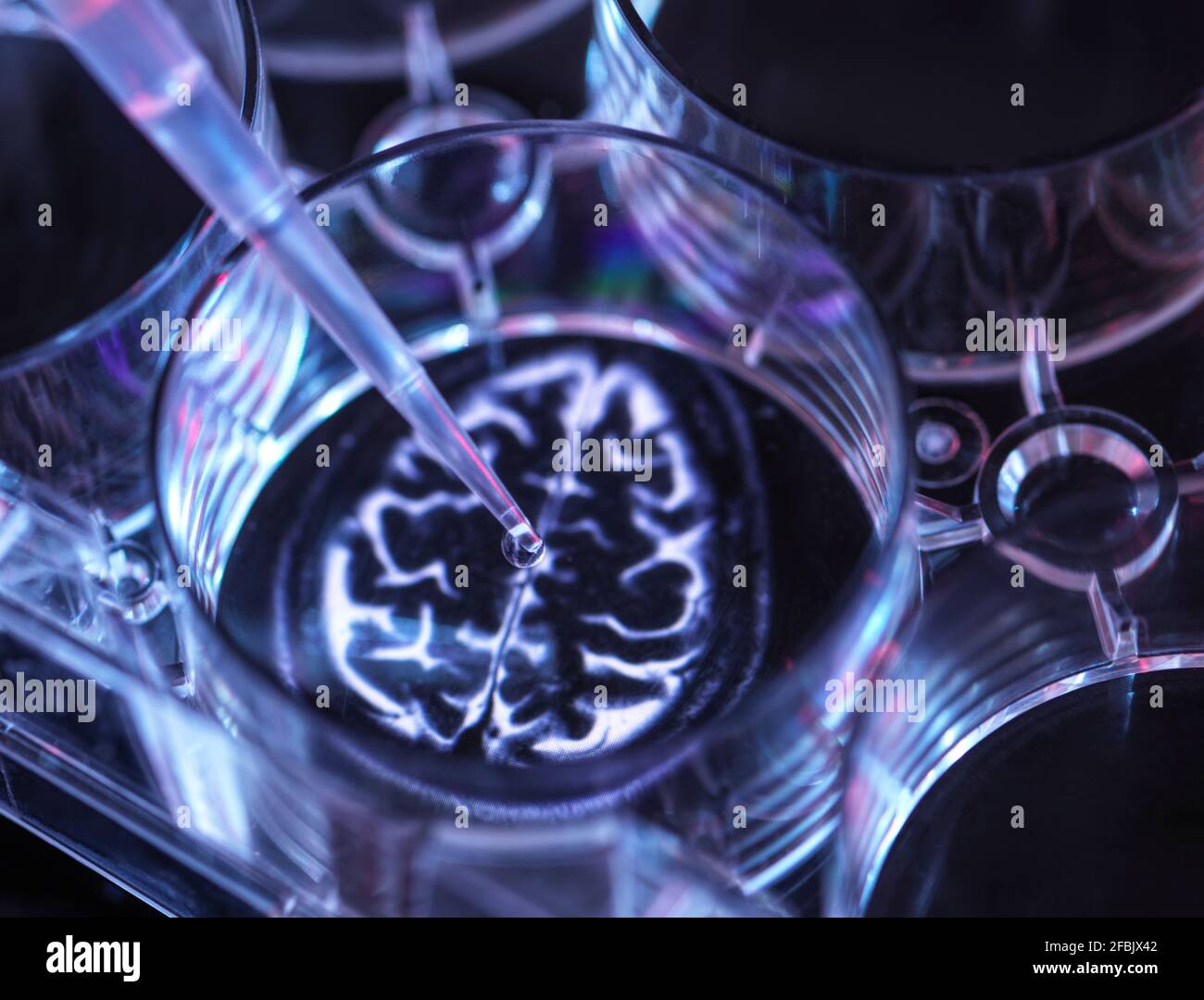 Medical sample inside microplate with image of human brain Stock Photo