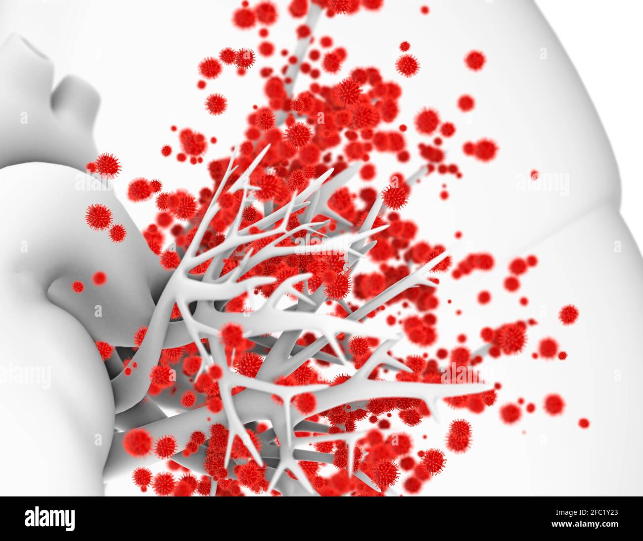 Viral lung infection, illustration Stock Photo Alamy