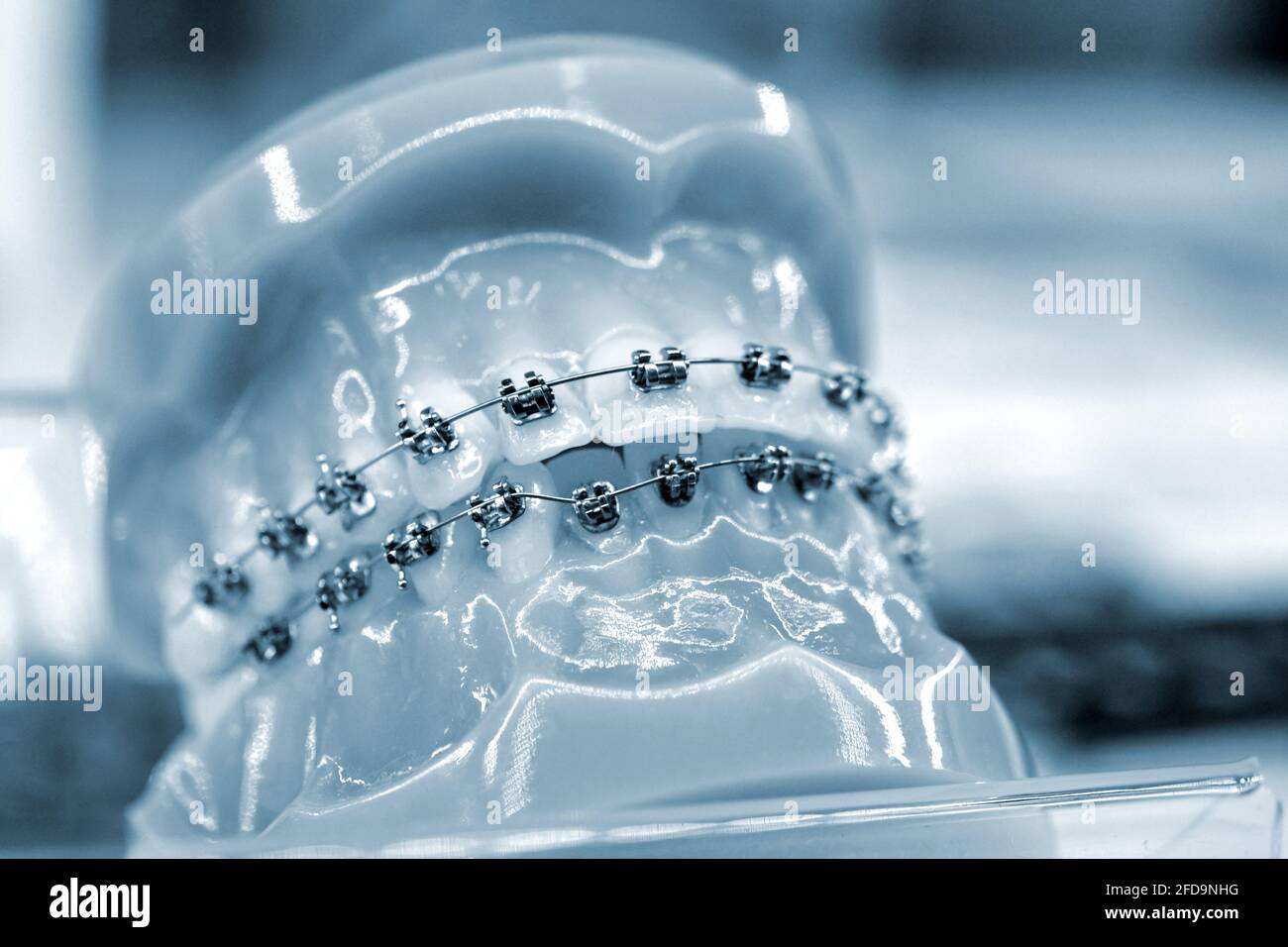 Plaque on teeth hires stock photography and images Alamy