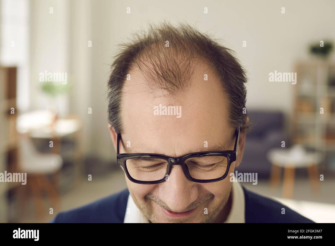 Closeup of top of head of cheerful balding mature man who needs hair loss treatment Stock Photo