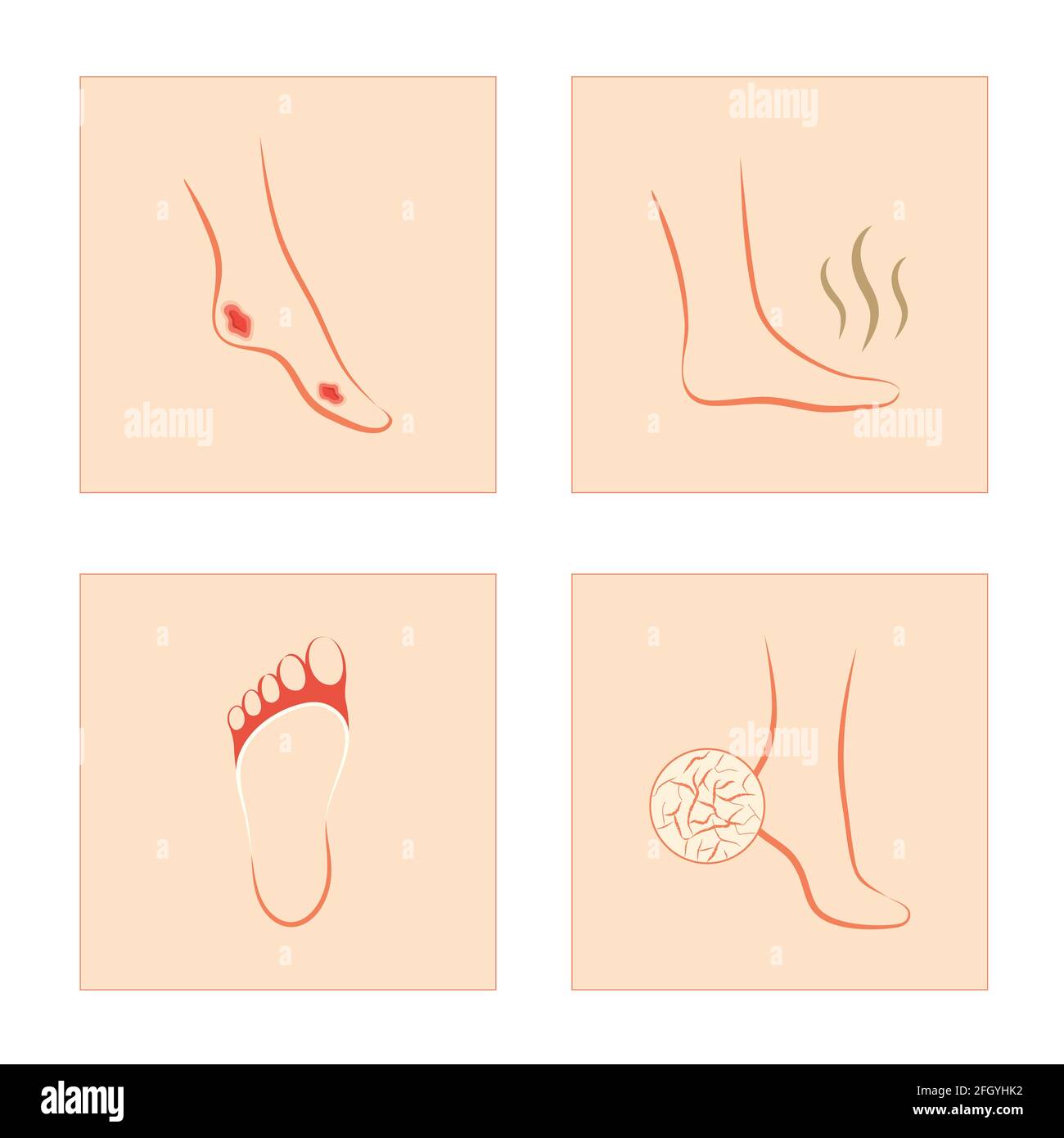 Fungal odor Stock Vector Images Alamy