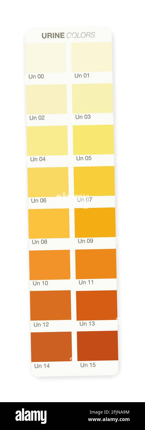 Uro Color Urine colors. Color stripe with index from clear urine to yellow and ...