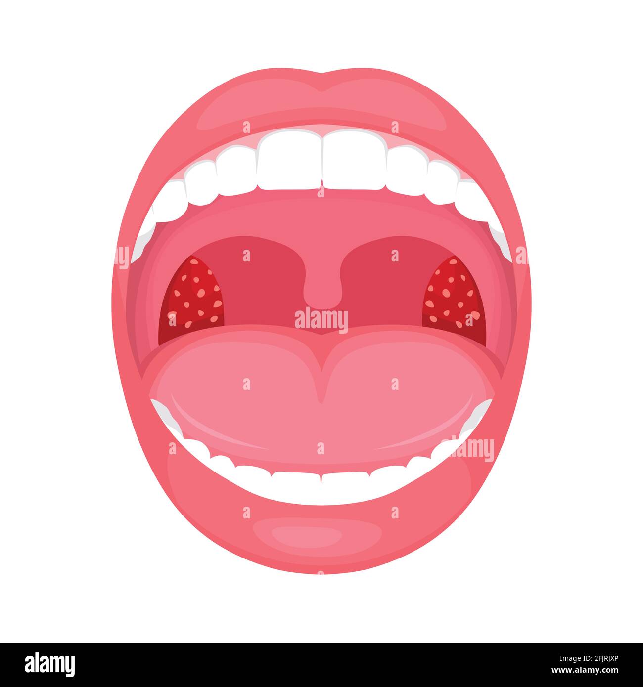 vector illustration of a throat bacterial and viral infection, tonsils inflammation. Stock Vector