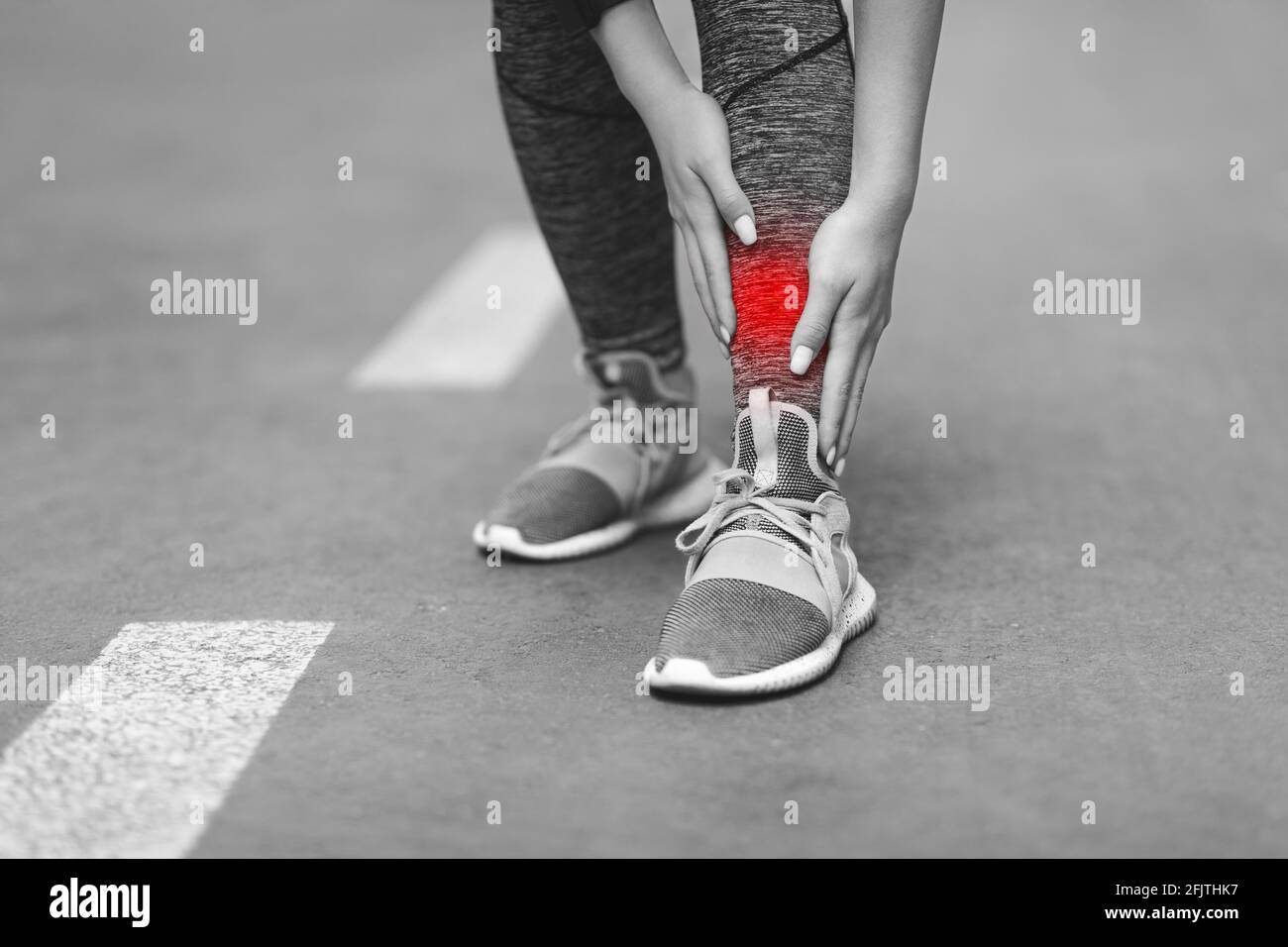 Leg Injury. Unrecognizable Woman Massaging Inflamed Shin Zone With Red ...
