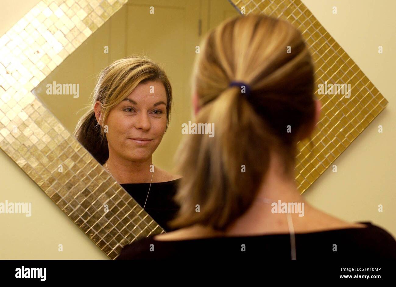 Case study Jaclyn Archer who has previously had a bad skin condition for many years.20 October