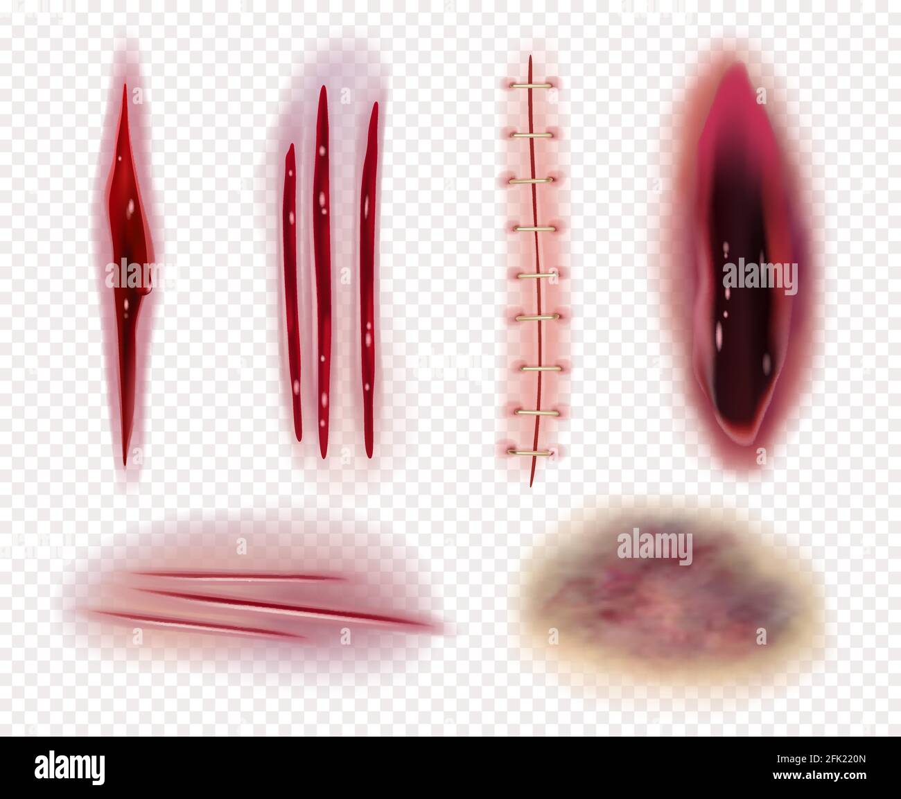 Realistic scars. Cuts wounds bruises bruises blood stitches vector templates collection Stock Vector