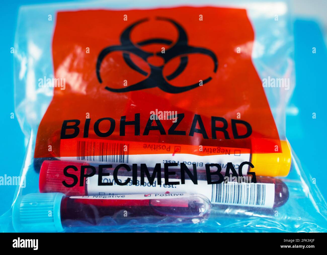 Covid patients blood samples in a medical waste bag. Medical Hazard Stock Photo