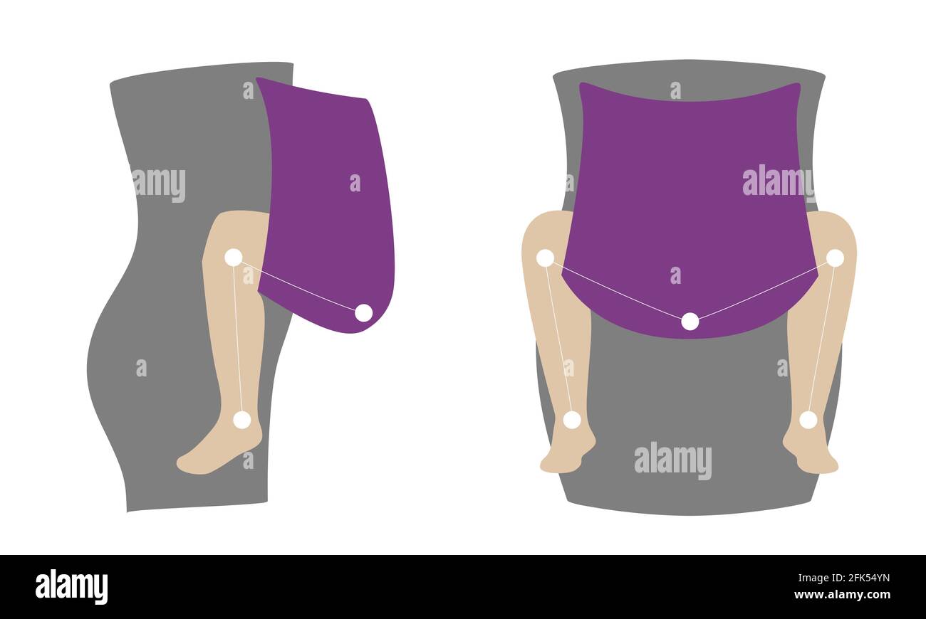 Schematic physiological position of the child in the carrier. M-position for the prevention of hip dysplasia. Stock Vector