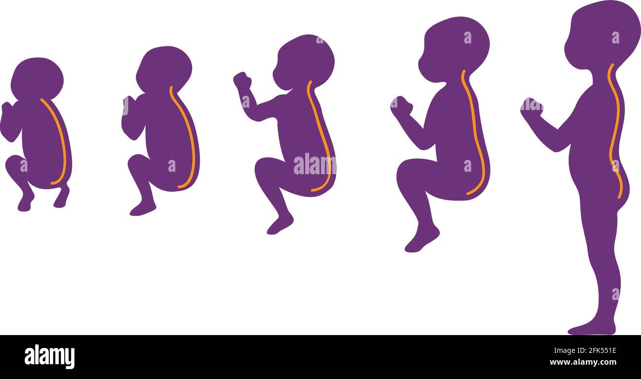 Stages of development of the curvature of the child's spine Stock Vector Image & Art Alamy