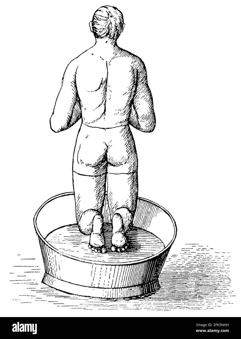Hydrotherapy of the back of the body. Illustration of the 19th century. Germany. White background. Stock Photo