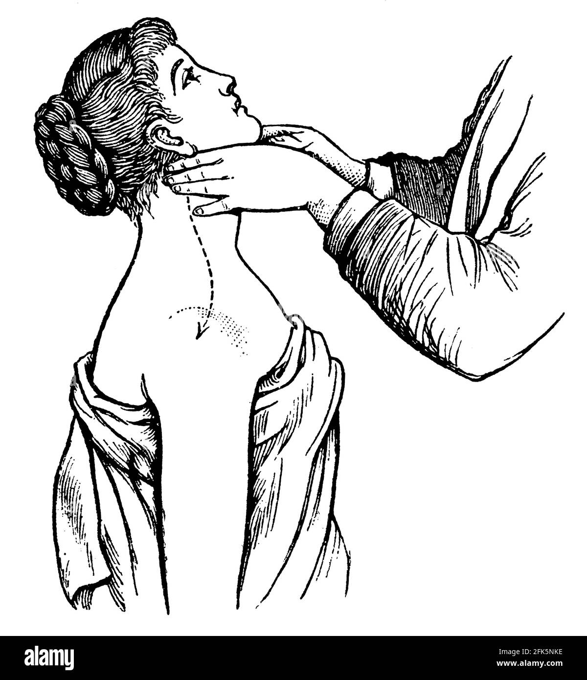 Neck massage. Illustration of the 19th century. Germany. White background. Stock Photo