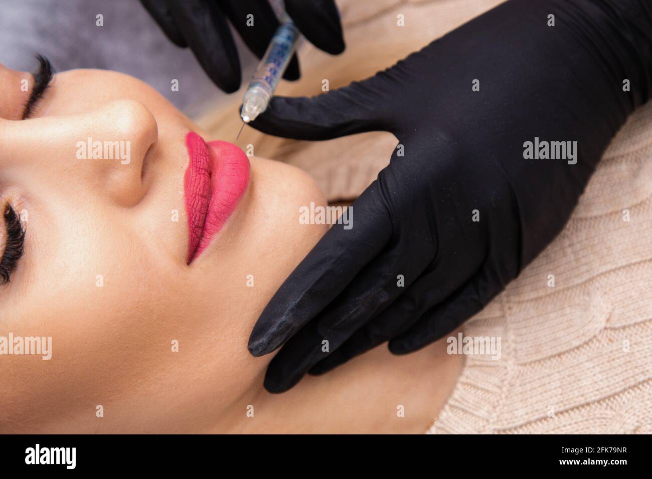 Caucasian woman receives procedure in spa salon for lip augmentation with geluronic acid. Beauty injections Stock Photo