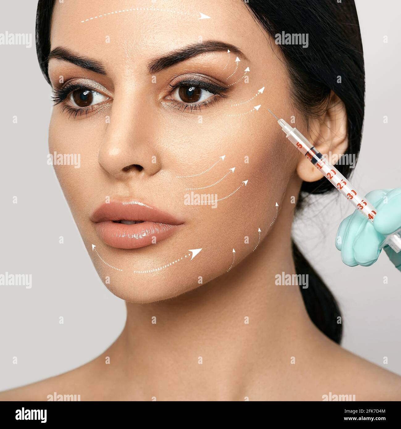 Facial mesotherapy. Face with lift arrows. Beautician doing antiaging
