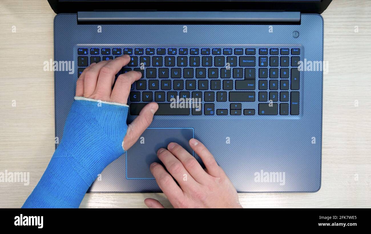 Top view of one hand scrolls on touchpad, other hand wrapped in fiberglass plaster cast typing on a laptop computer on a keyboard. A freelancer with one broken wrist works the Internet at home Stock Photo