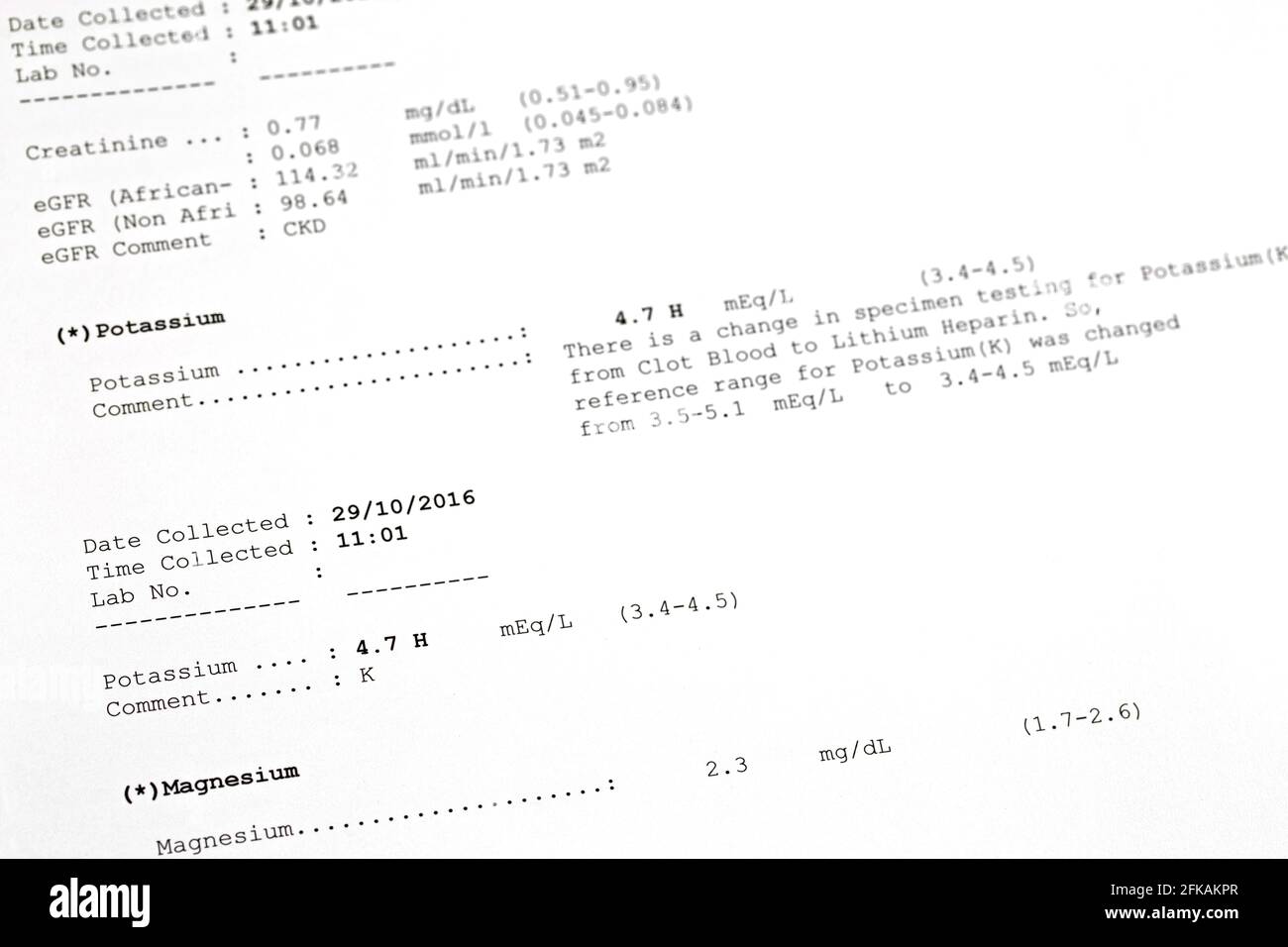 Soft focus of printed result paper of Potassium, Magnesium Levels in Blood.  Lab test for potassium, magnesium deficiency Stock Photo - Alamy