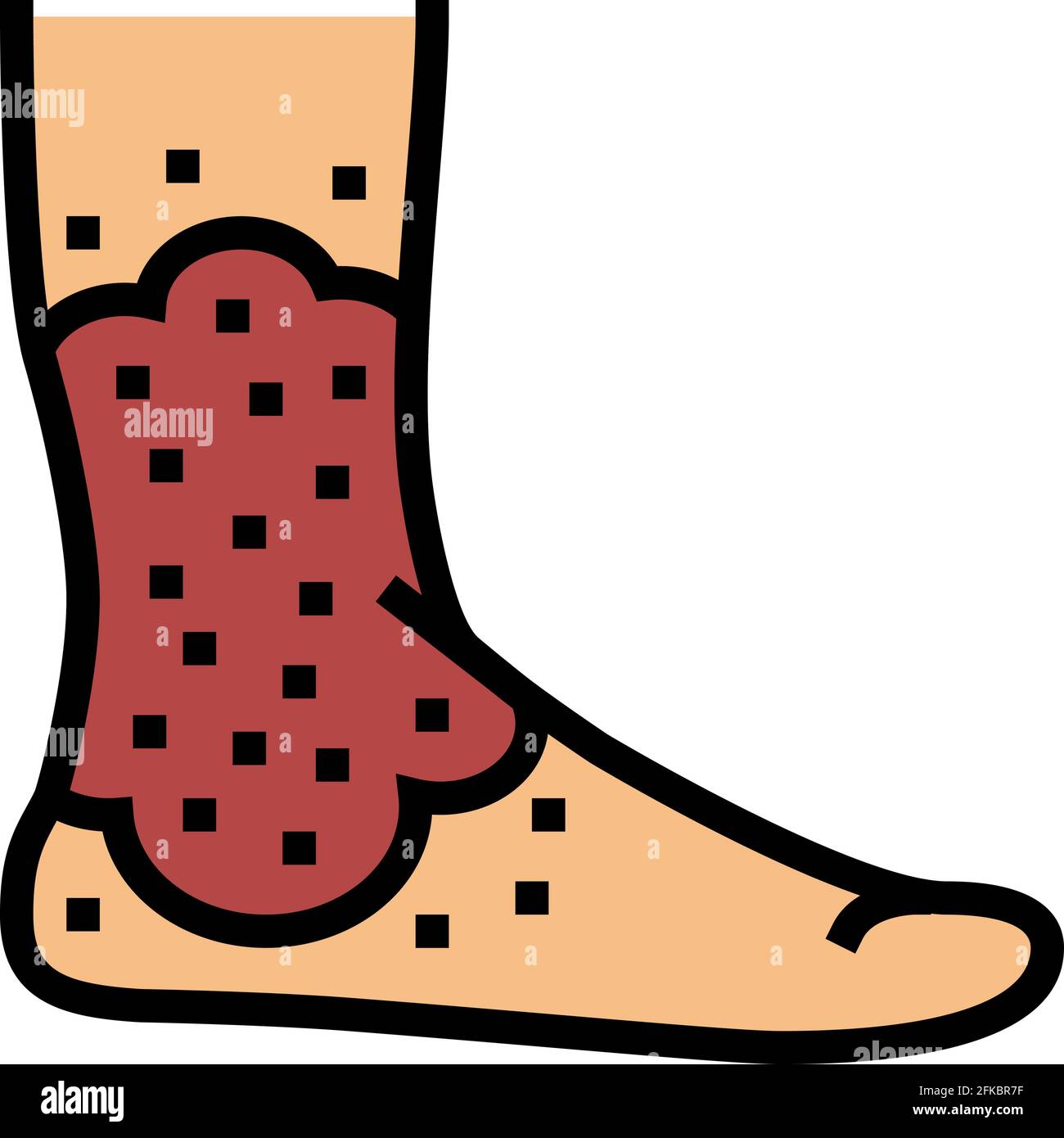 stasis dermatitis color icon vector illustration Stock Vector