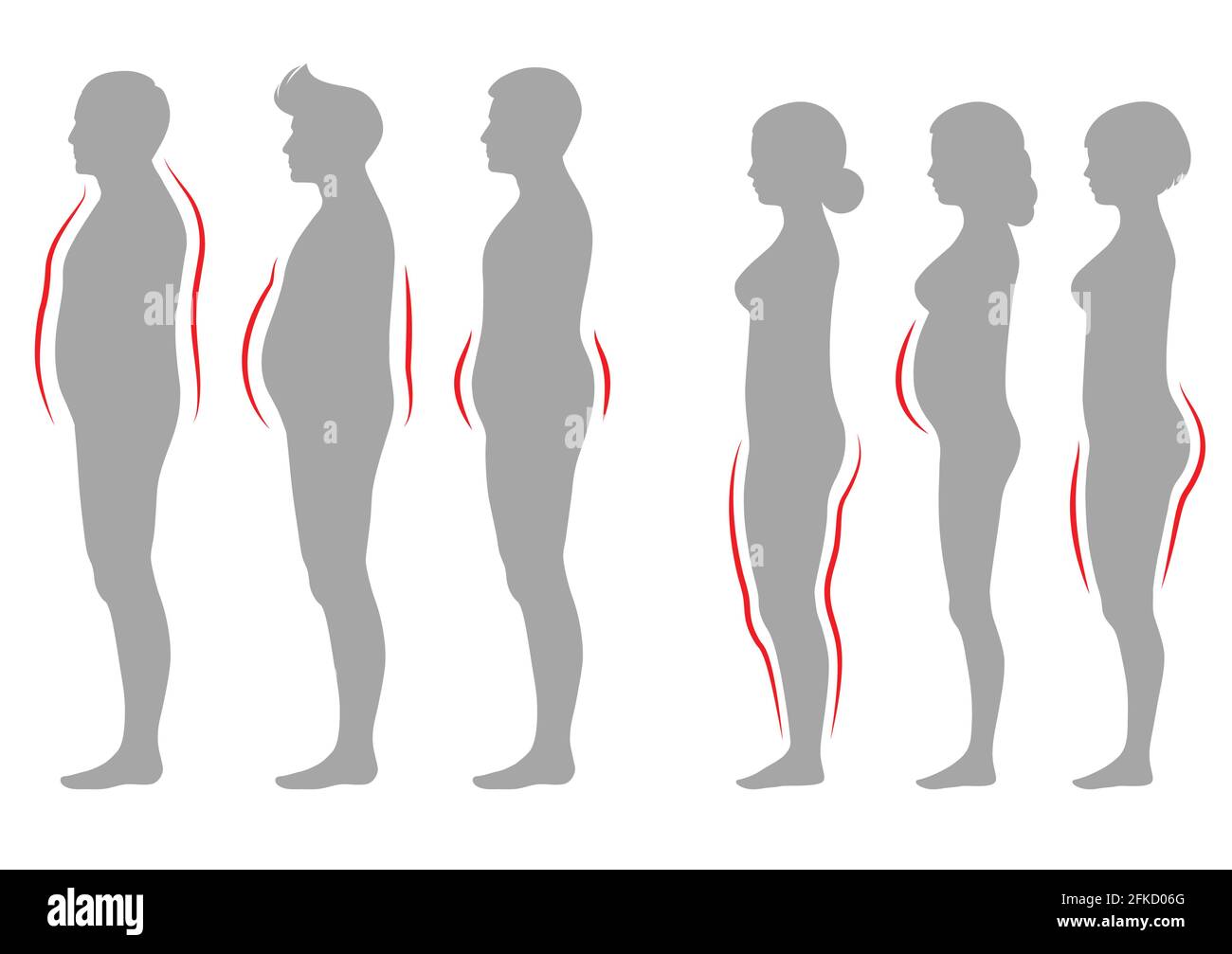 obesity woman and man body type, vector figure overweight silhouette Stock Vector