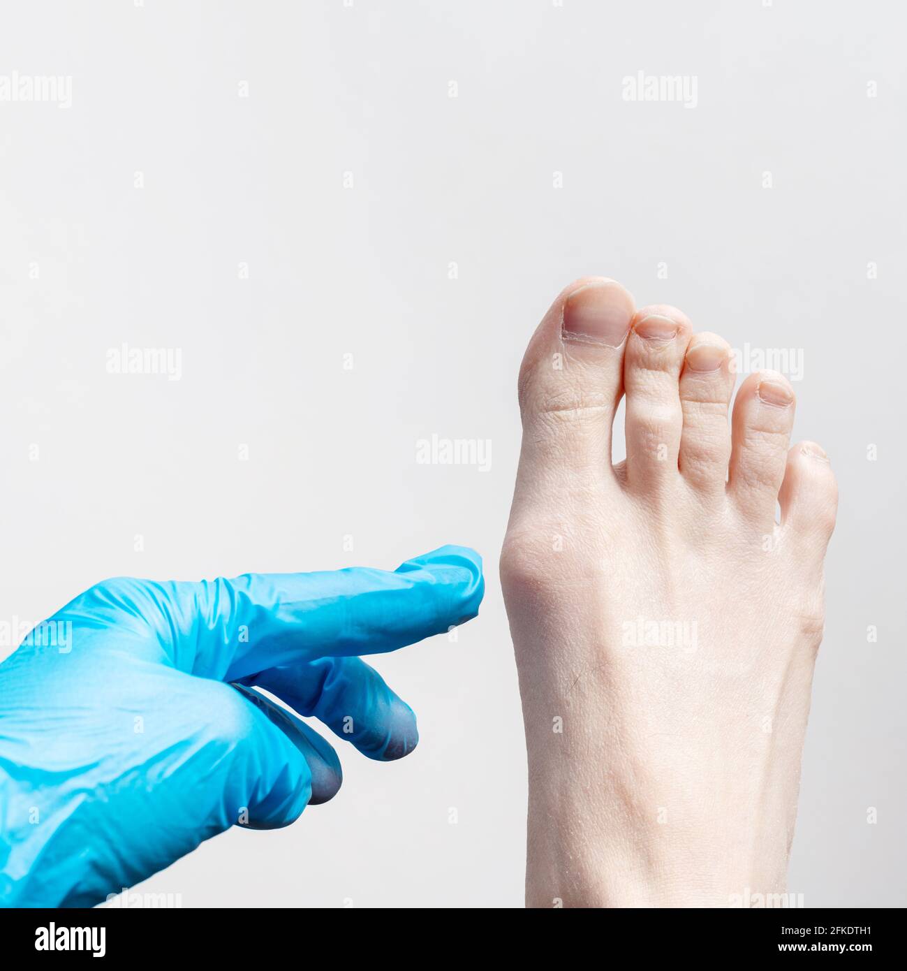 Hand in a blue medical glove, an orthopedic surgeon examines a woman's