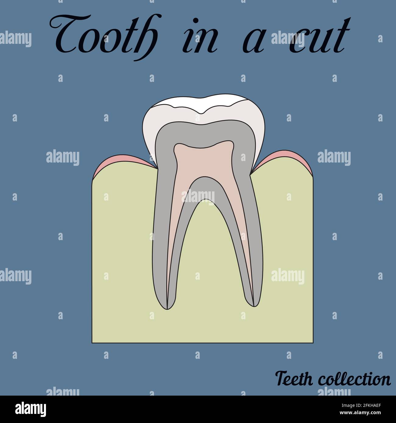 tooth in a cut Stock Vector