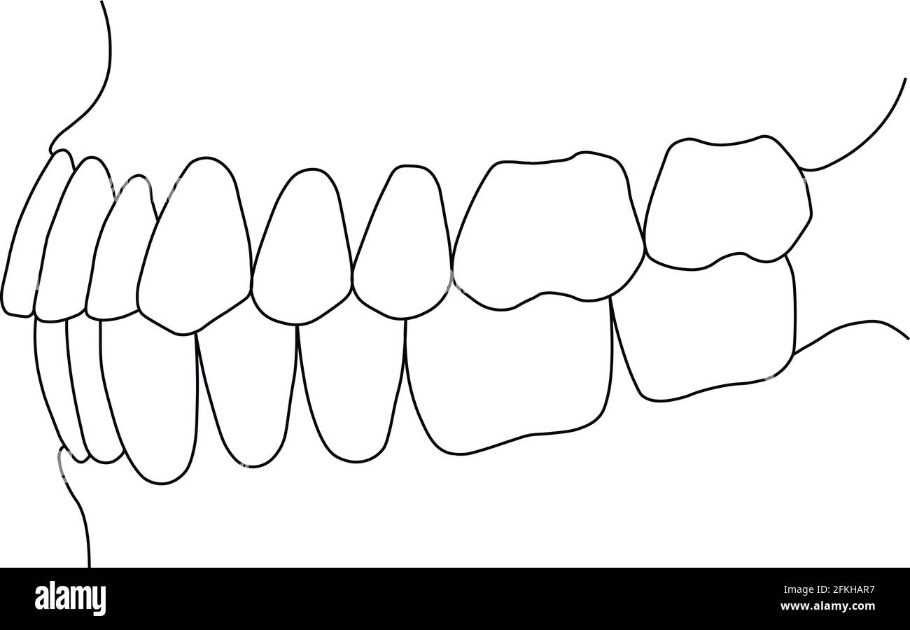 dental bite Stock Vector