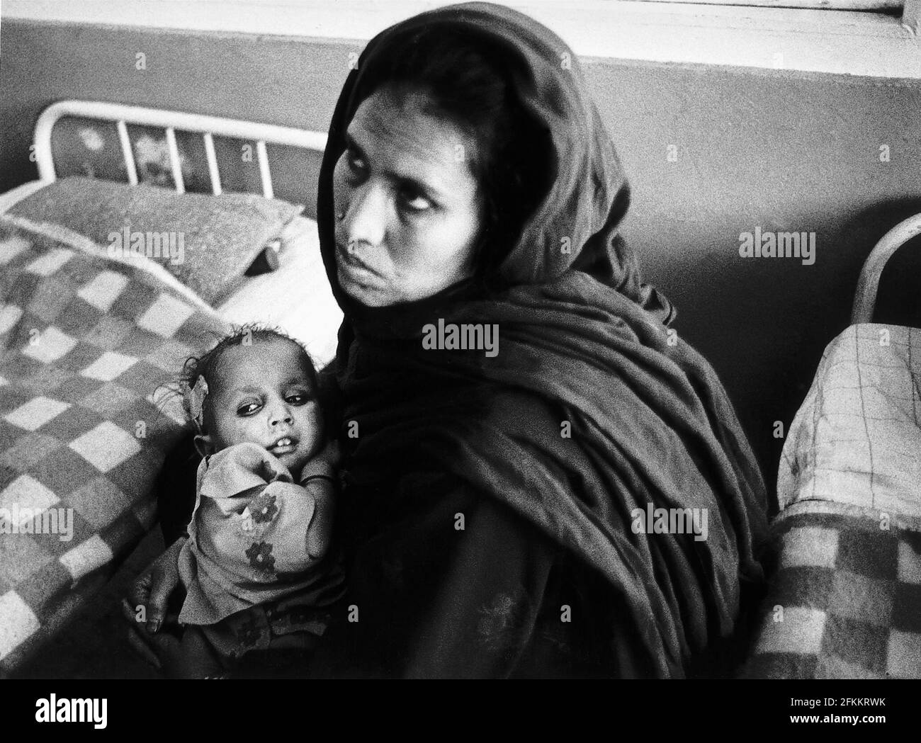 Afghanistan Child Suffering   Indira gandhi Hospital Kabul she is ill with malnutrition Stock Photo
