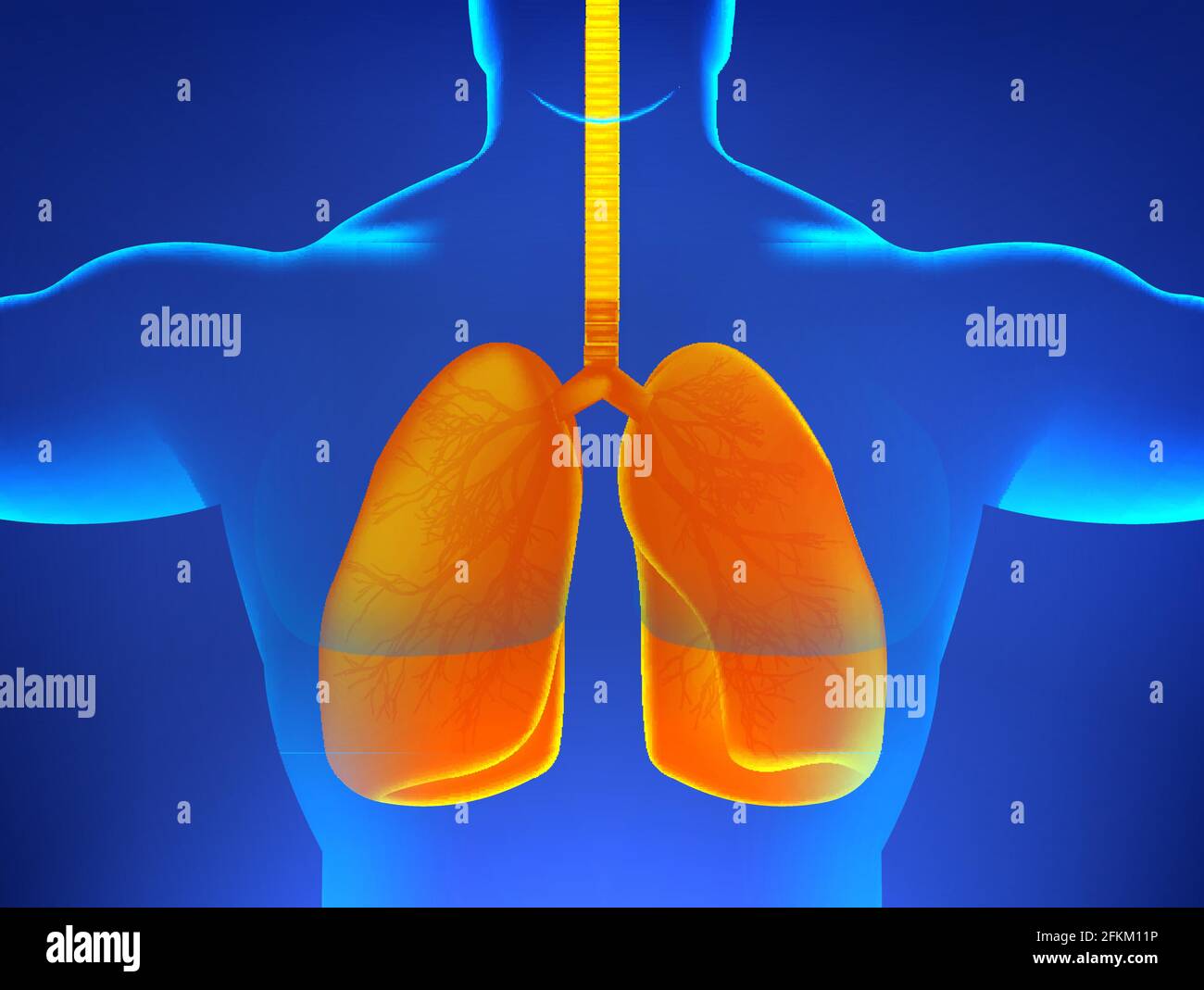X-ray human body with sick lungs, pneumonia, virus, asthma or other diseases associated with the human lungs. 3D human body hologram and orange lungs Stock Vector