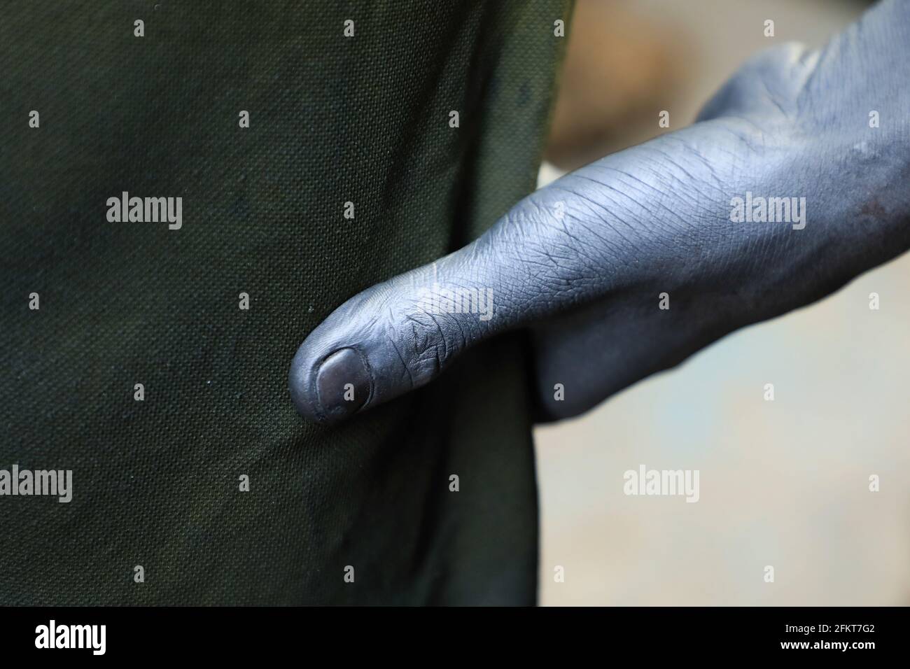 Dhaka, Bangladesh. 03rd May, 2021. 15 years old Md Masum shows off his oil smeared hands from the work at an Aluminium cooking pot manufacturing factory. Aluminum Factory is very common in Bangladesh where different kinds of pot and jar made from aluminum. Such industry creates a sound source of employment. Among these workers many of them are children aged less than 15 years. Credit: SOPA Images Limited/Alamy Live News Stock Photo