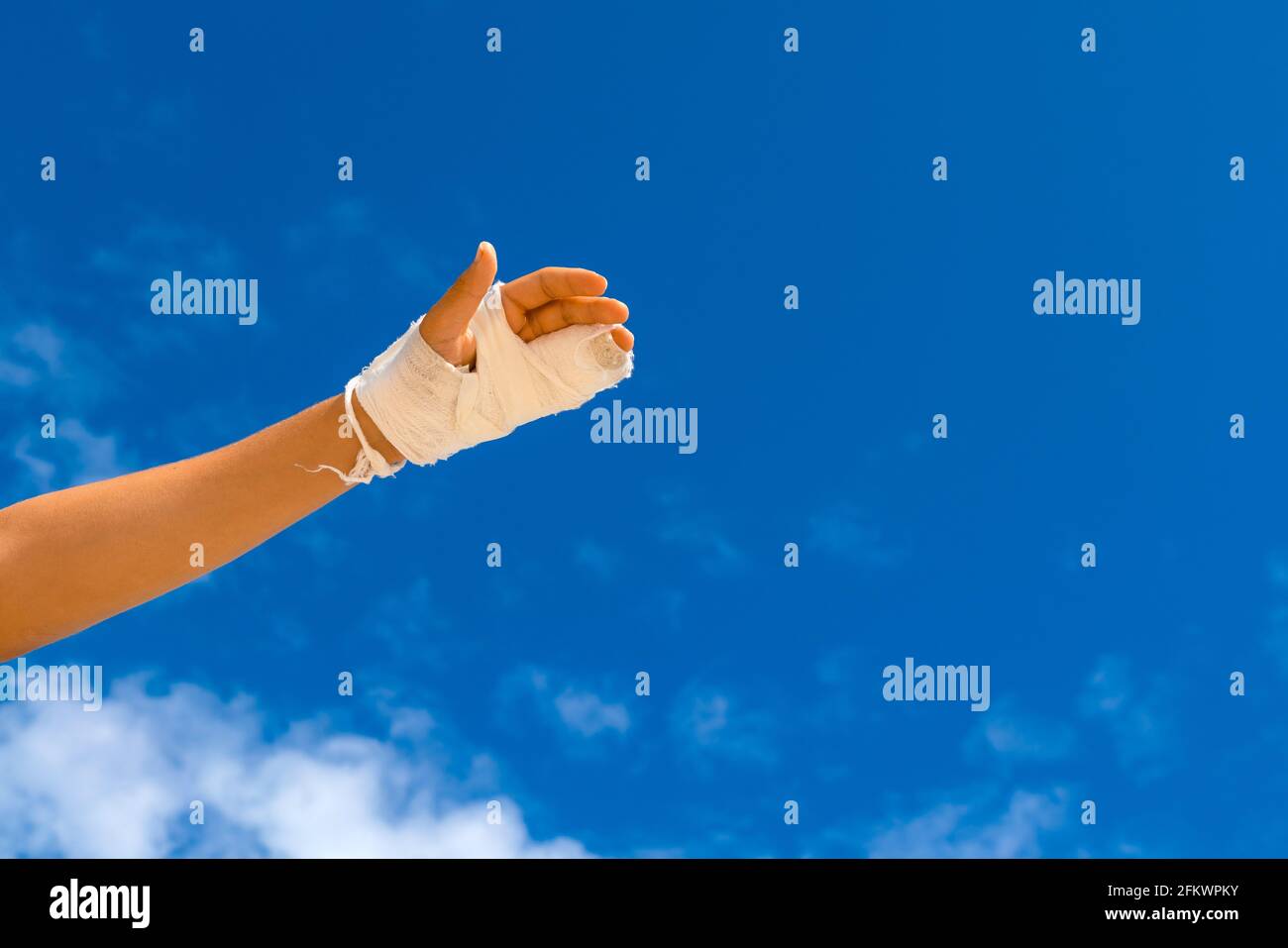 Broken hand in white cast on blue background with copy space for text. Finger cast trauma. Stock Photo