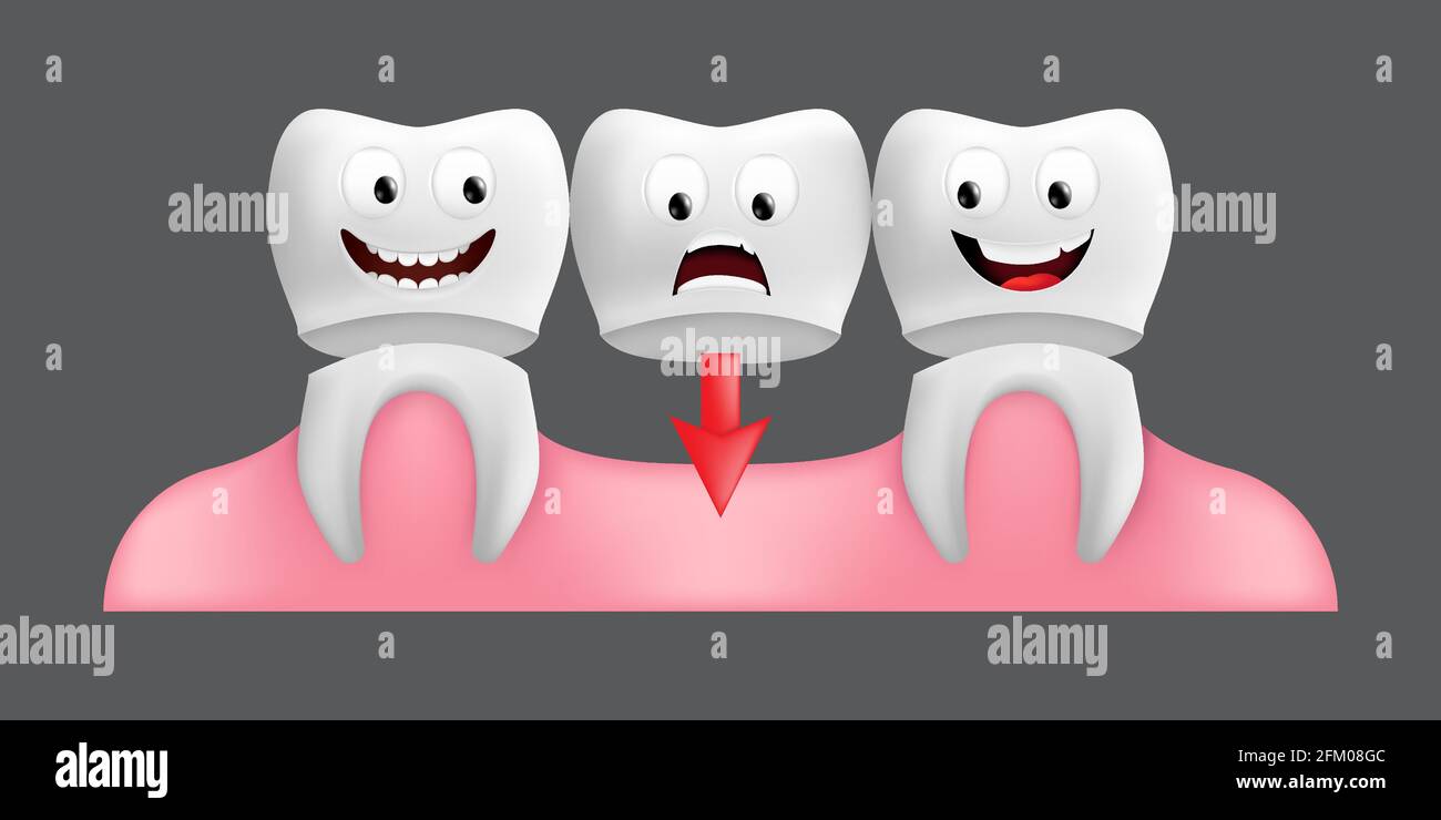 Smiling teeth with fixed bridgework. Cute character with facial expression. Funny icon for children's design. 3d realistic vector illustration of a de Stock Vector