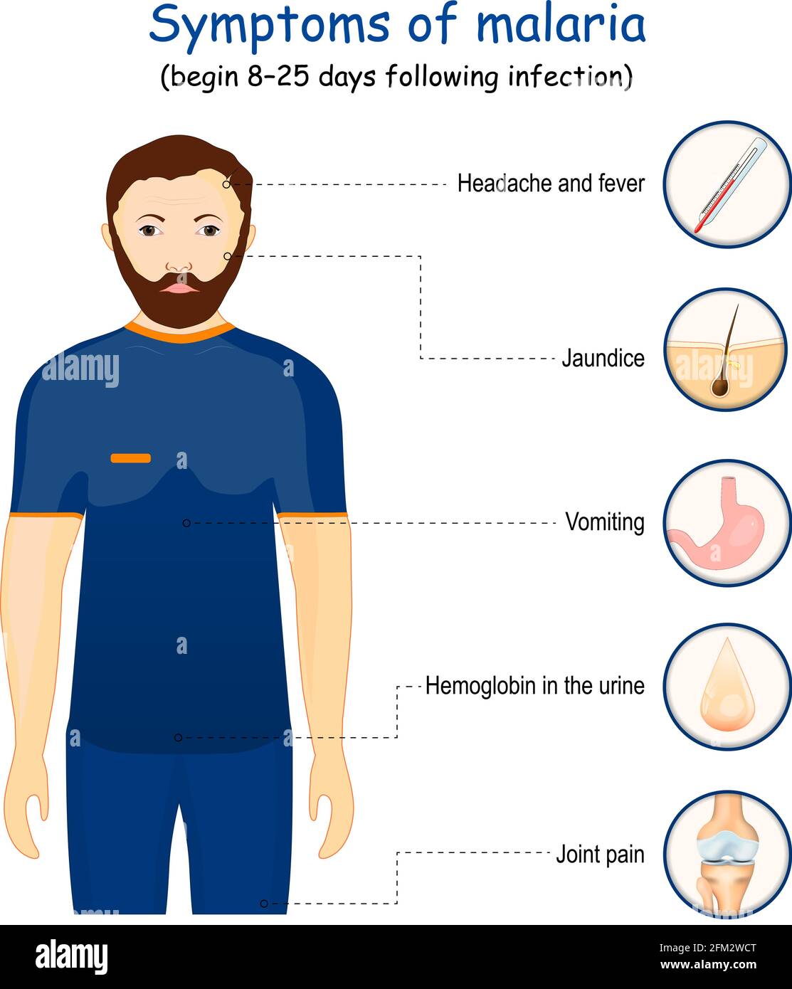 malaria. Signs and symptoms of mosquito-borne infectious disease that