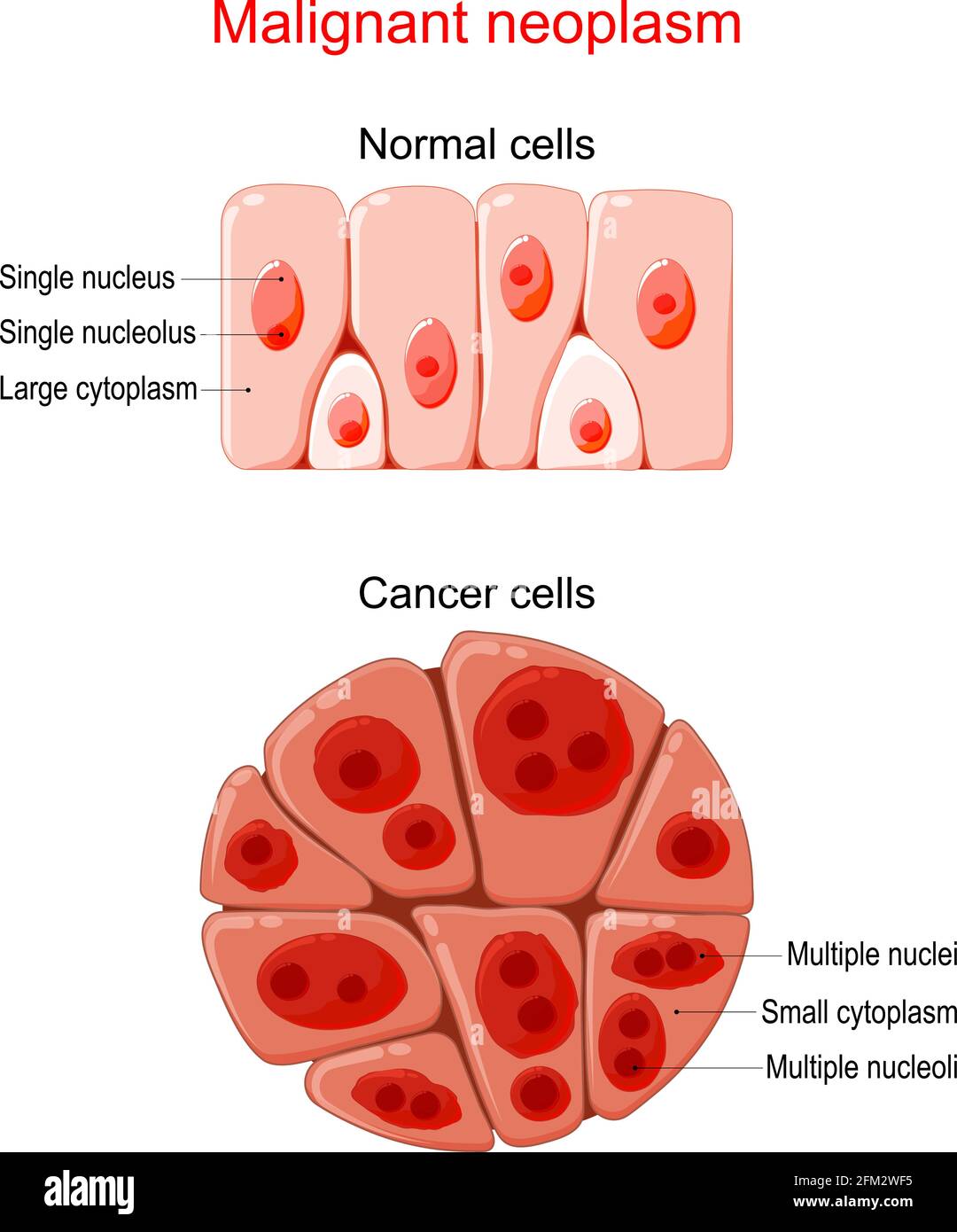 Cancer Cells vs. Normal Cells: How Are They Different?