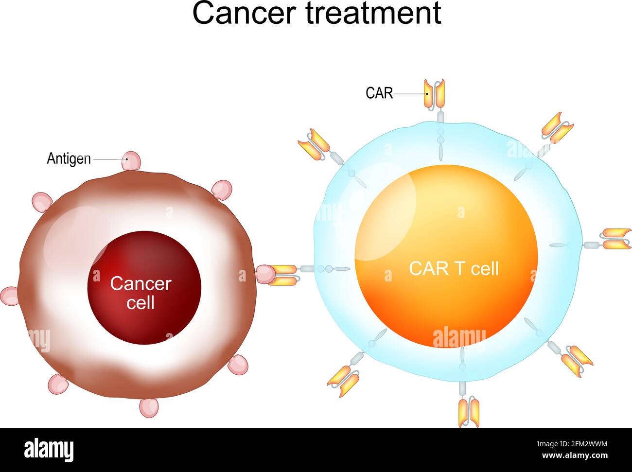 Cancer treatment and CAR T-cell therapy. Chimeric antigen receptor T cells. CAR T cells. Vector Stock Vector