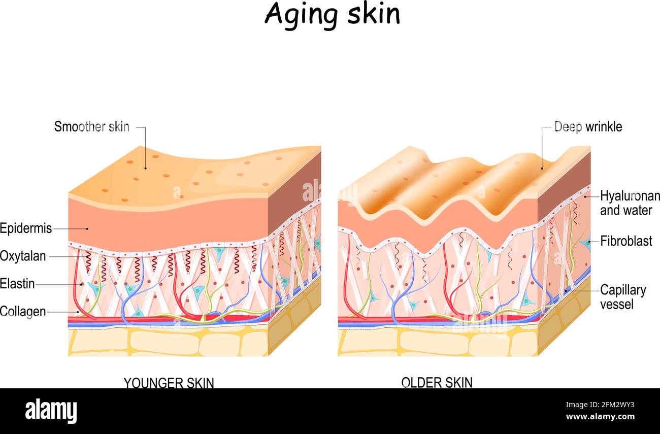 Aging skin. comparison and difference between older and younger skin. Close-up of fibroblast, collagen, elastin, and Oxytalan fibers, Hyaluronic acid. Stock Vector