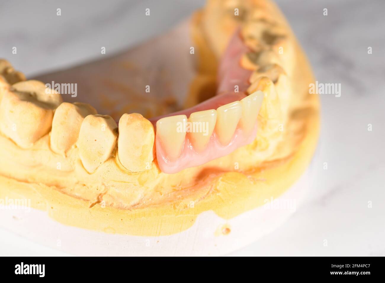 Plaster moulds for making False teeth with false teeth in place Stock Photo Alamy