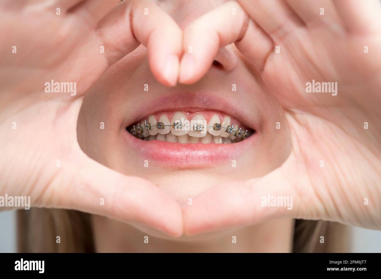 Caucasian woman in braces holding fingers in the shape of a heart Stock
