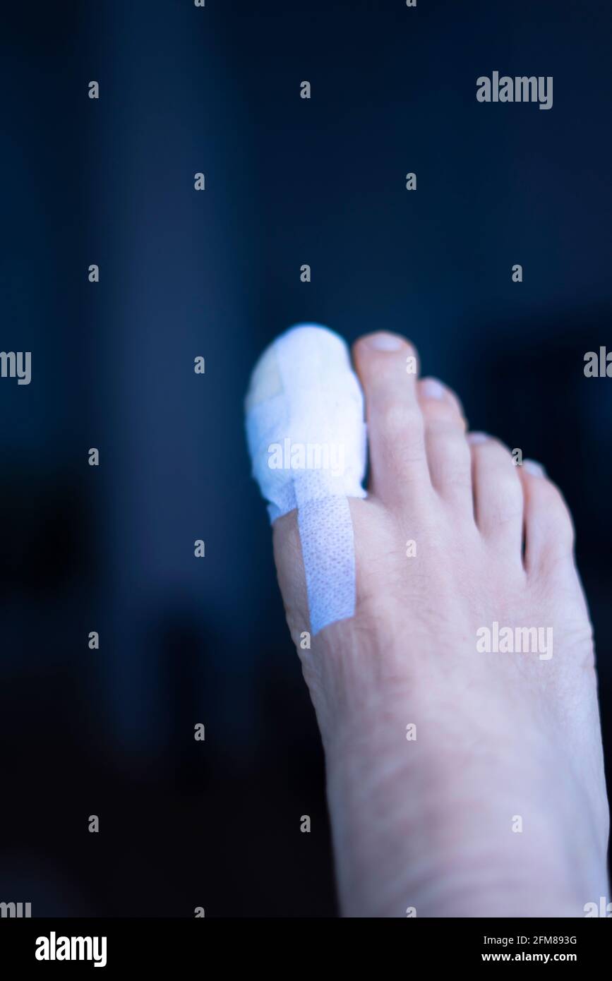 Foot big toe bandage injured feet in medical clinic hospital center